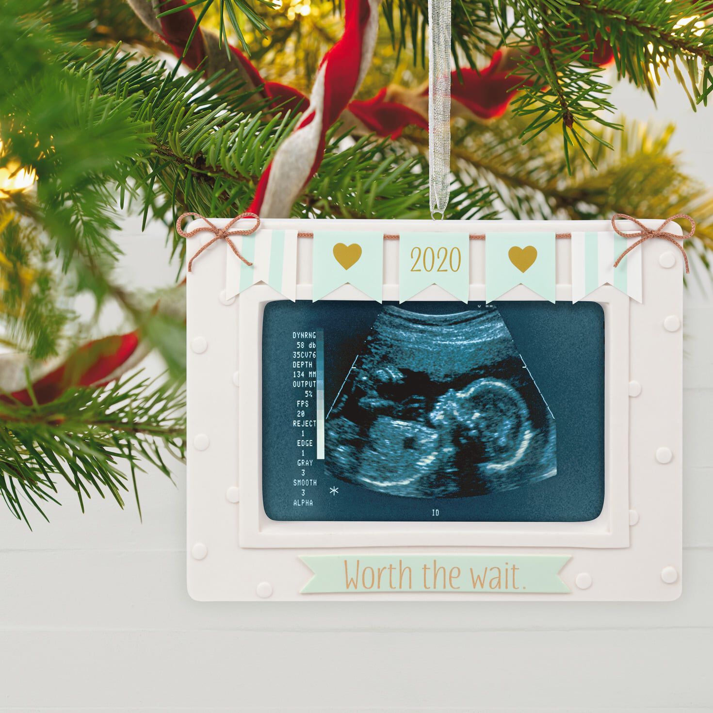 baby ultrasound christmas ornament